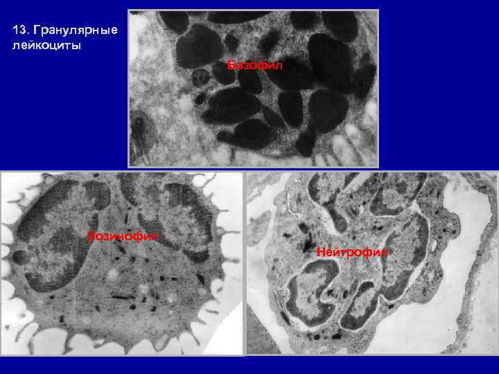 13. Гранулярные лейкоциты Базофил Эозинофил Нейтрофил 