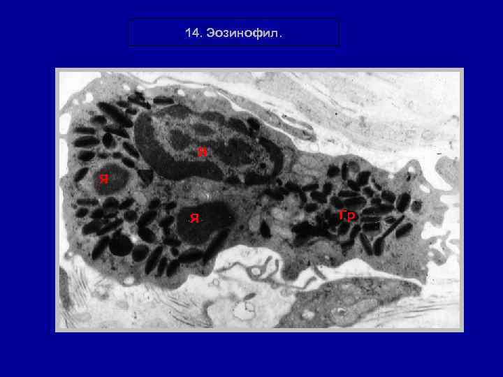 14. Эозинофил. Я Я Я Гр 