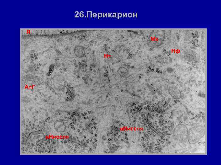 26. Перикарион Я Мх Нф Нт Ап. Г в. Ниссля 