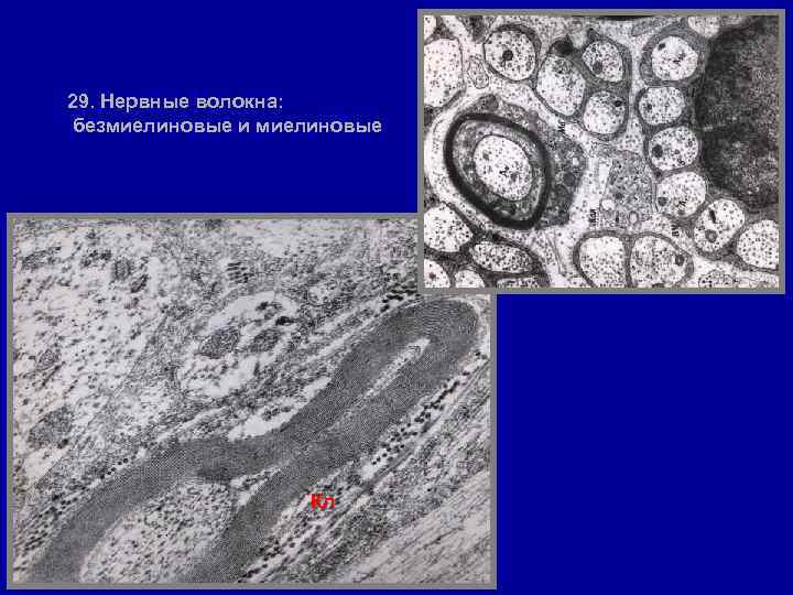 29. Нервные волокна: безмиелиновые и миелиновые Кл 