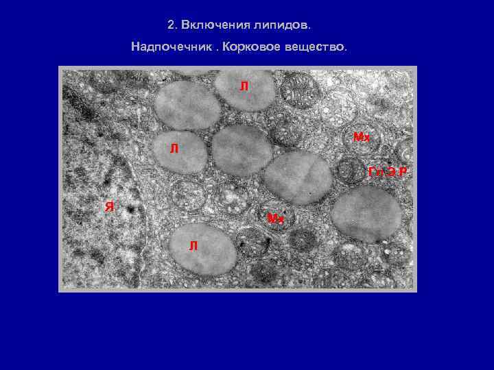 2. Включения липидов. Надпочечник. Корковое вещество. Л Мх Л Гл. Э. Р. Я Мх