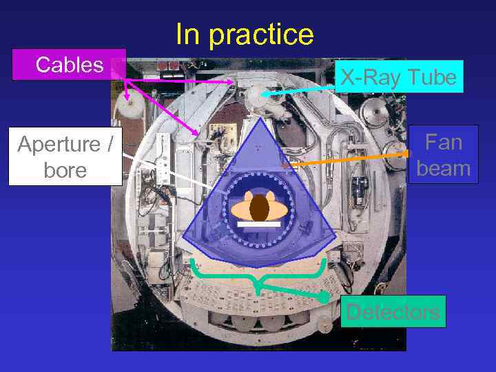 In practice Cables Aperture / bore X-Ray Tube Fan beam Detectors 