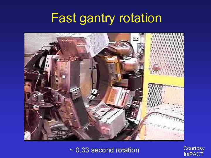 Fast gantry rotation ~ 0. 33 second rotation Courtesy Im. PACT 