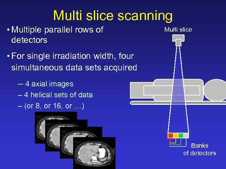 Multi slice scanning • Multiple parallel rows of detectors Multi slice • For single