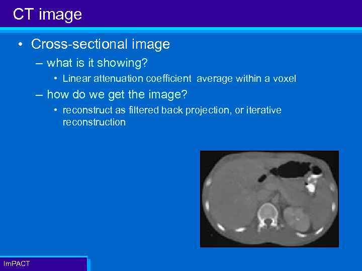 CT image • Cross-sectional image – what is it showing? • Linear attenuation coefficient