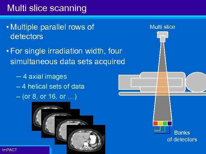 Multi slice scanning • Multiple parallel rows of detectors Multi slice • For single