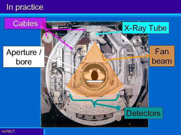 In practice Cables Aperture / bore X-Ray Tube Fan beam Detectors Im. PACT 