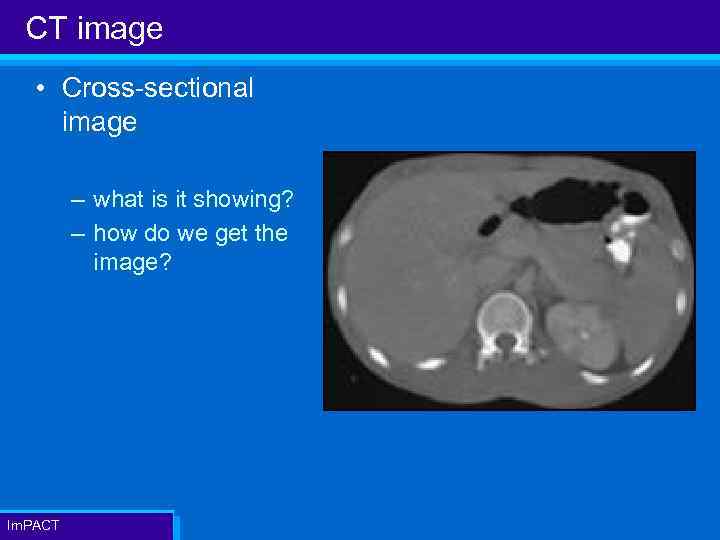 CT image • Cross-sectional image – what is it showing? – how do we