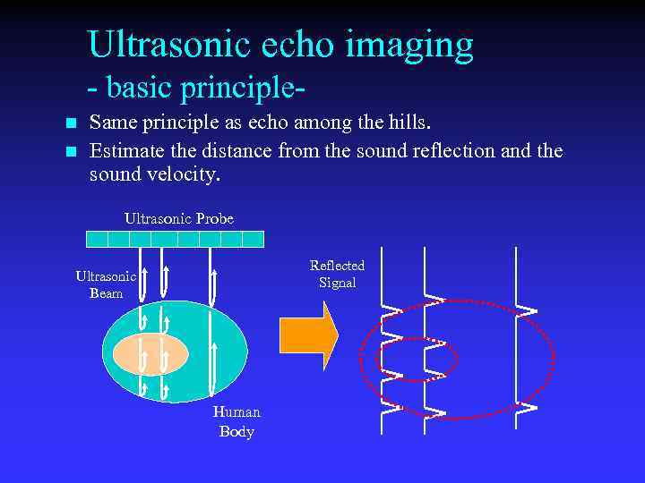 Ultrasonic echo imaging - basic principlen n Same principle as echo among the hills.