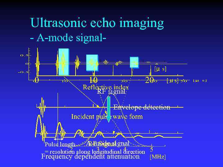 Ultrasonic echo imaging - A-mode signal- RF signal Envelope detection A-mode signal Pulse length