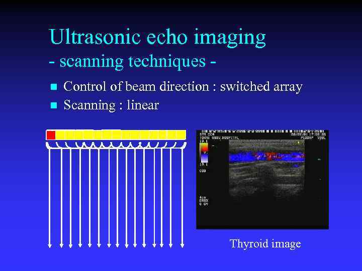 Ultrasonic echo imaging - scanning techniques n n Control of beam direction : switched