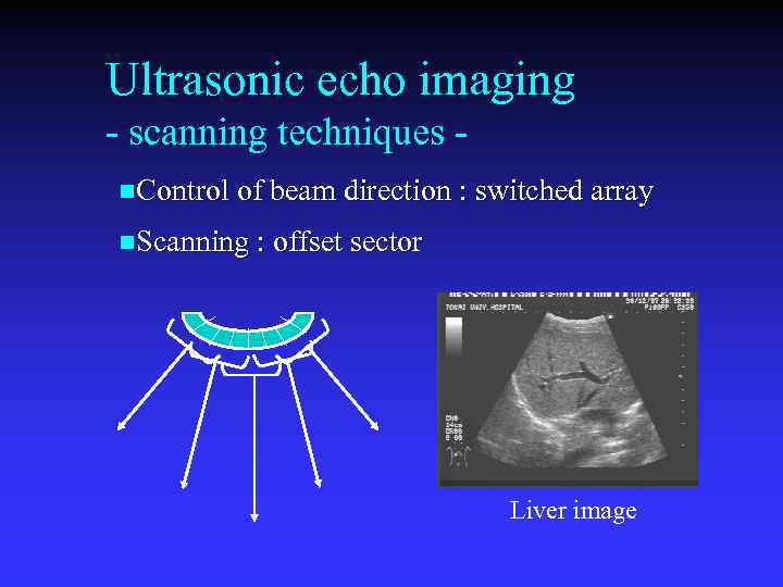 Ultrasonic echo imaging - scanning techniques n. Control of beam direction : switched array