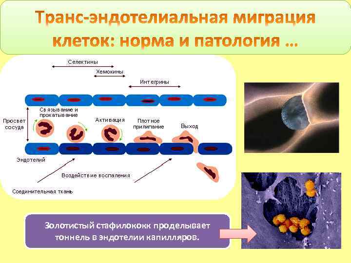 Золотистый стафилококк проделывает тоннель в эндотелии капилляров. 