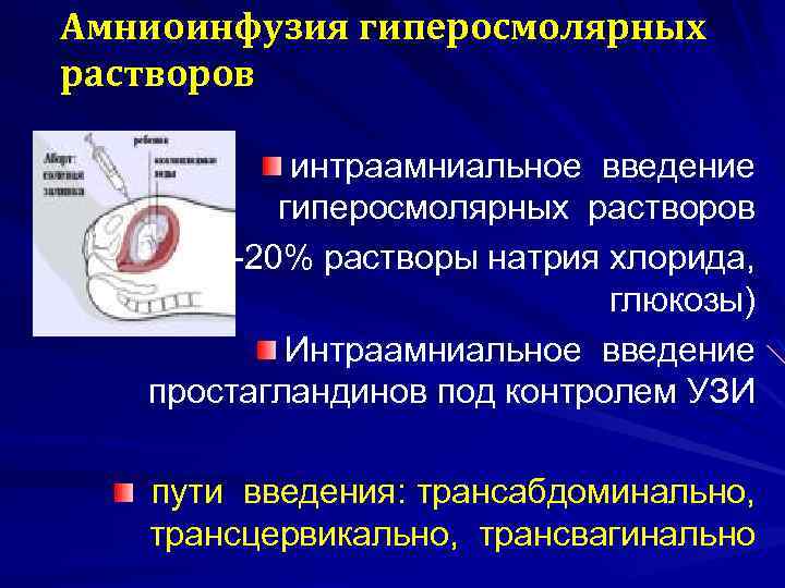 Амниоинфузия гиперосмолярных растворов интраамниальное введение гиперосмолярных растворов (10 -20% растворы натрия хлорида, глюкозы) Интраамниальное