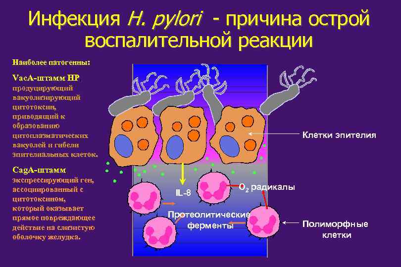 Инфекция H. pylori - причина острой воспалительной реакции Наиболее патогенны: Vас. А-штамм НР, продуцирующий