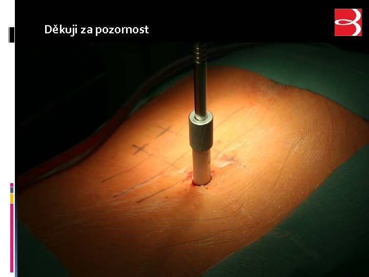 Děkuji za pozornost 
