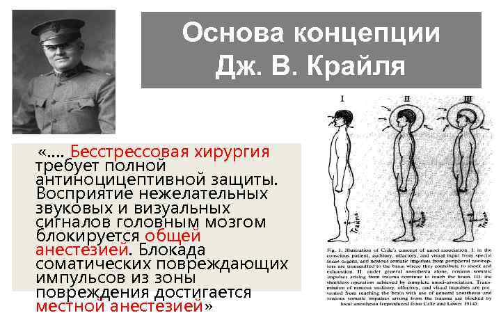 Основа концепции Дж. В. Крайля «…. Бесстрессовая хирургия требует полной антиноцицептивной защиты. Восприятие нежелательных