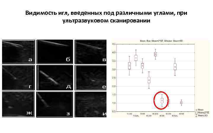 Видимость игл, введенных под различными углами, при ультразвуковом сканировании 
