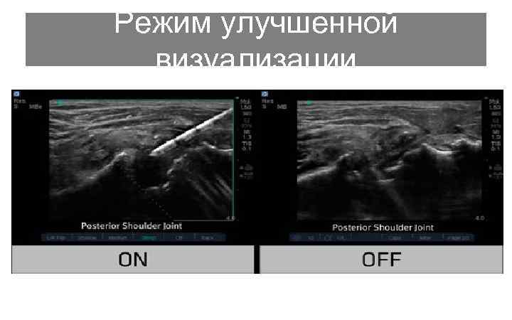 Режим улучшенной визуализации 