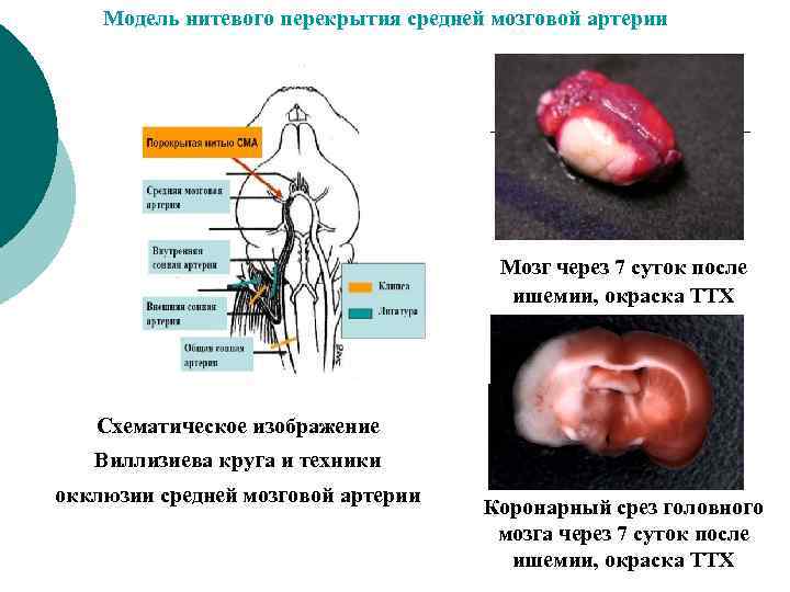 Модель нитевого перекрытия средней мозговой артерии Мозг через 7 суток после ишемии, окраска ТТХ