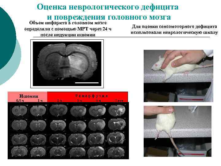 Оценка неврологического дефицита и повреждения головного мозга Объем инфаркта в головном мозге определяли с