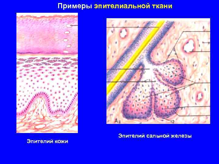 Примеры эпителиальной ткани Эпителий кожи Эпителий сальной железы 