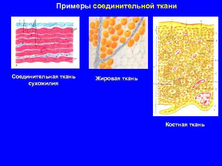 Примеры соединительной ткани Соединительная ткань сухожилия Жировая ткань Костная ткань 