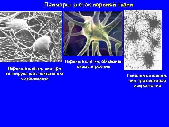 Примеры клеток нервной ткани Нервные клетки, объемная схема строения Нервные клетки, вид при сканирующей