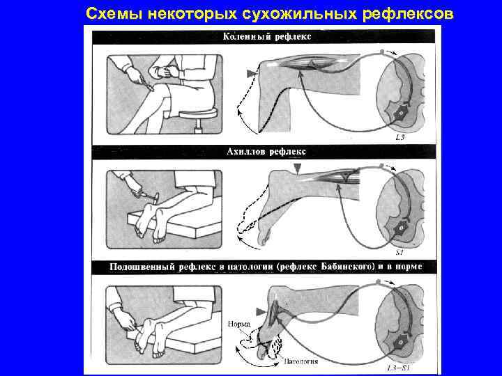 Схемы некоторых сухожильных рефлексов 