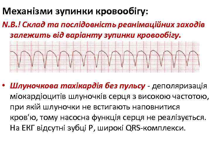 Механізми зупинки кровообігу: N. B. ! Склад та послідовність реанімаційних заходів залежить від варіанту