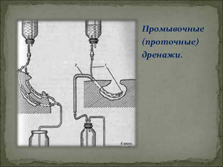 Промывочные (проточные) дренажи. 