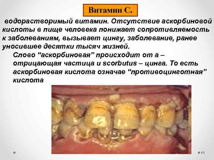 Витамин С. водорастворимый витамин. Отсутствие аскорбиновой кислоты в пище человека понижает сопротивляемость к заболеваниям,