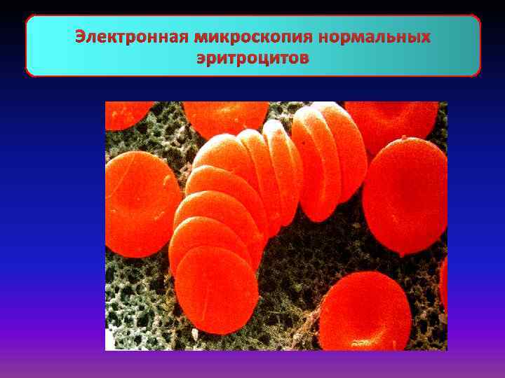 Электронная микроскопия нормальных эритроцитов 