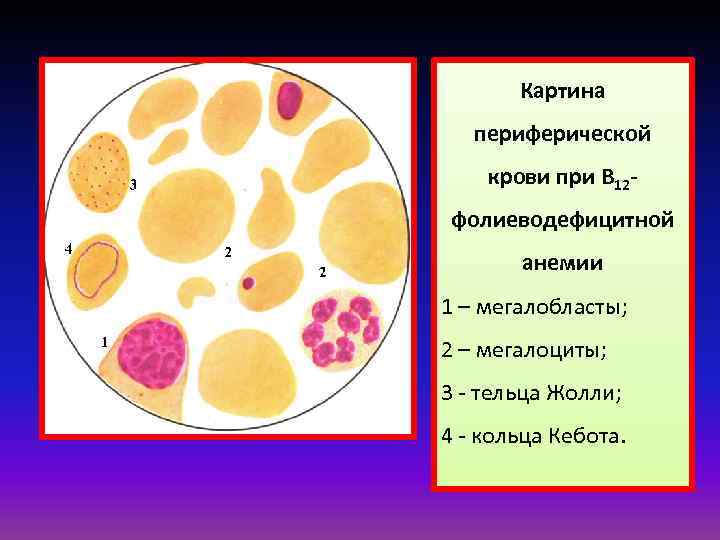 Картина крови при фолиеводефицитной анемии