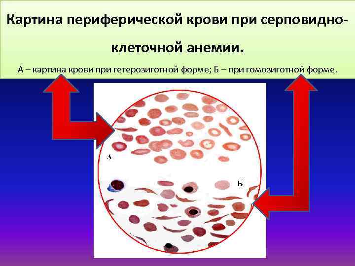 Состав периферической крови