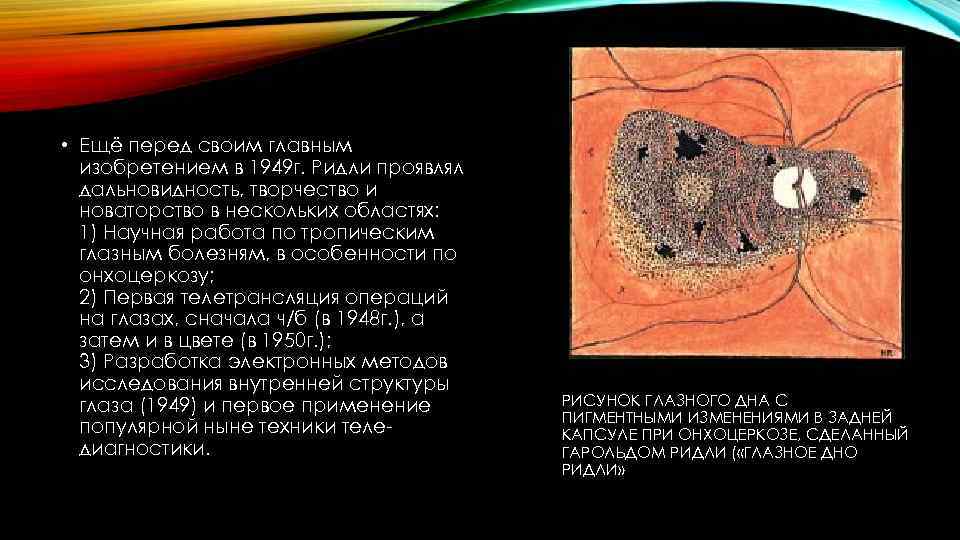  • Ещё перед своим главным изобретением в 1949 г. Ридли проявлял дальновидность, творчество