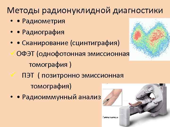 Методы радионуклидной диагностики • • Радиометрия • • Радиография • • Сканирование (сцинтиграфия) ü