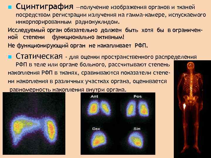 Сцинтиграфия —получение изображения органов и тканей посредством регистрации излучения на гамма-камере, испускаемого инкорпорированным радионуклидом.