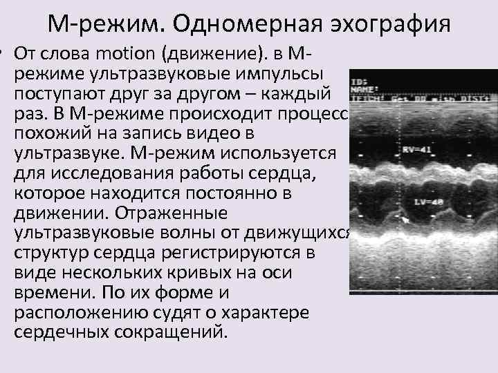 М-режим. Одномерная эхография • От слова motion (движение). в Мрежиме ультразвуковые импульсы поступают друг