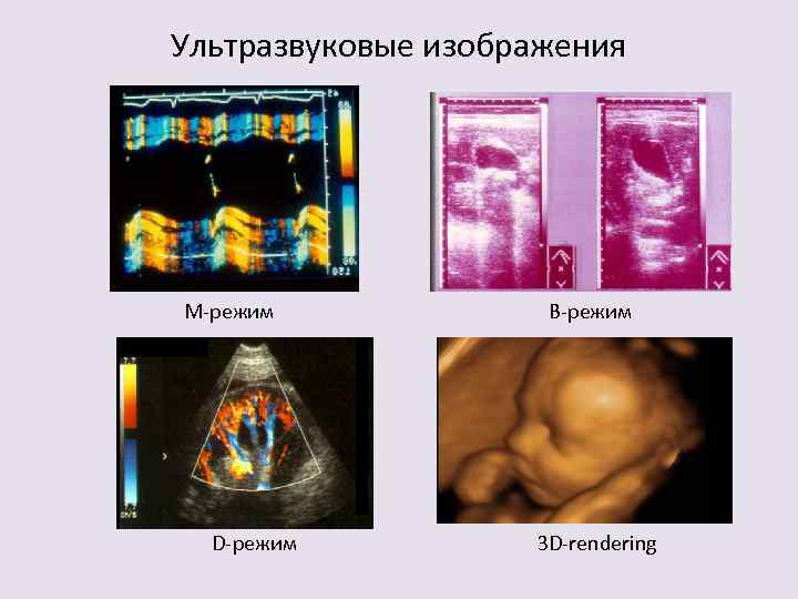 Ультразвуковые изображения М-режим D-режим В-режим 3 D-rendering 