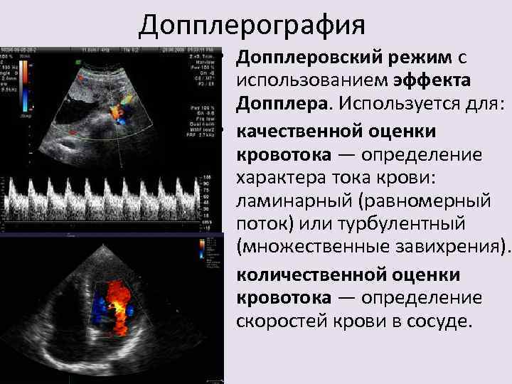 Измерение кровотока