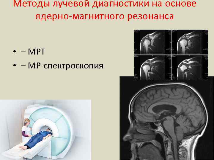 Методы лучевой диагностики на основе ядерно-магнитного резонанса • – МРТ • – МР-спектроскопия 