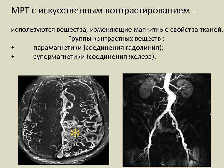 МРТ с искусственным контрастированием – используются вещества, изменяющие магнитные свойства тканей. Группы контрастных веществ
