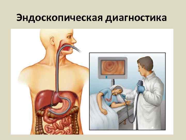 Эндоскопическая диагностика 
