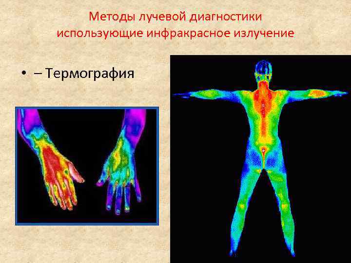 Методы лучевой диагностики использующие инфракрасное излучение • – Термография 