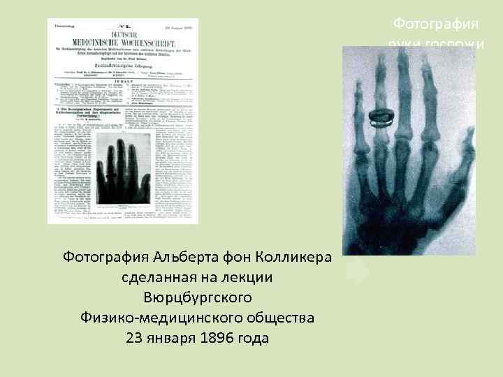 Фотография руки госпожи Рентген, сделанная 22 декабря 1895 года Фотография Альберта фон Колликера сделанная