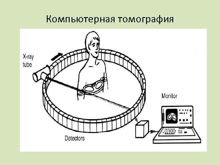 Компьютерная томография 