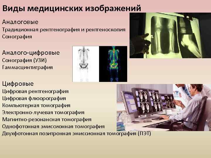 Виды медицинских изображений Аналоговые Традиционная рентгенография и рентгеноскопия Сонография Аналого-цифровые Сонография (УЗИ) Гаммасцинтиграфия Цифровые