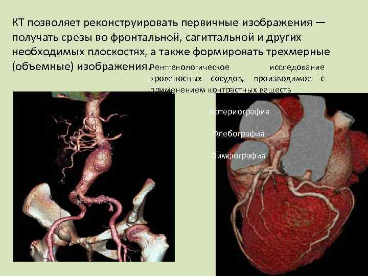 КТ позволяет реконструировать первичные изображения — получать срезы во фронтальной, сагиттальной и других необходимых