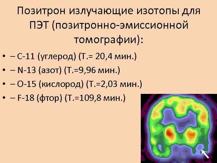Позитрон излучающие изотопы для ПЭТ (позитронно-эмиссионной томографии): • • – С-11 (углерод) (T. =
